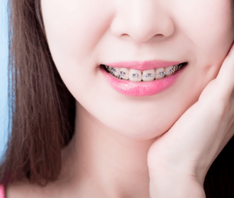 大人の矯正治療