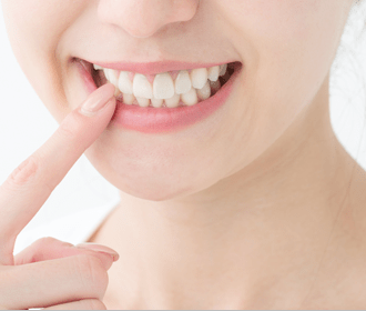 目立ちにくい矯正装置による治療